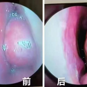 天津大港油田林益通鼻康堂